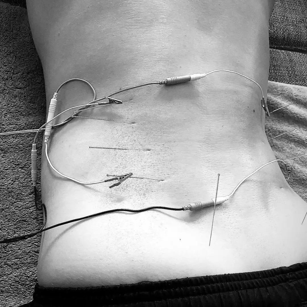acupuncture the body expert