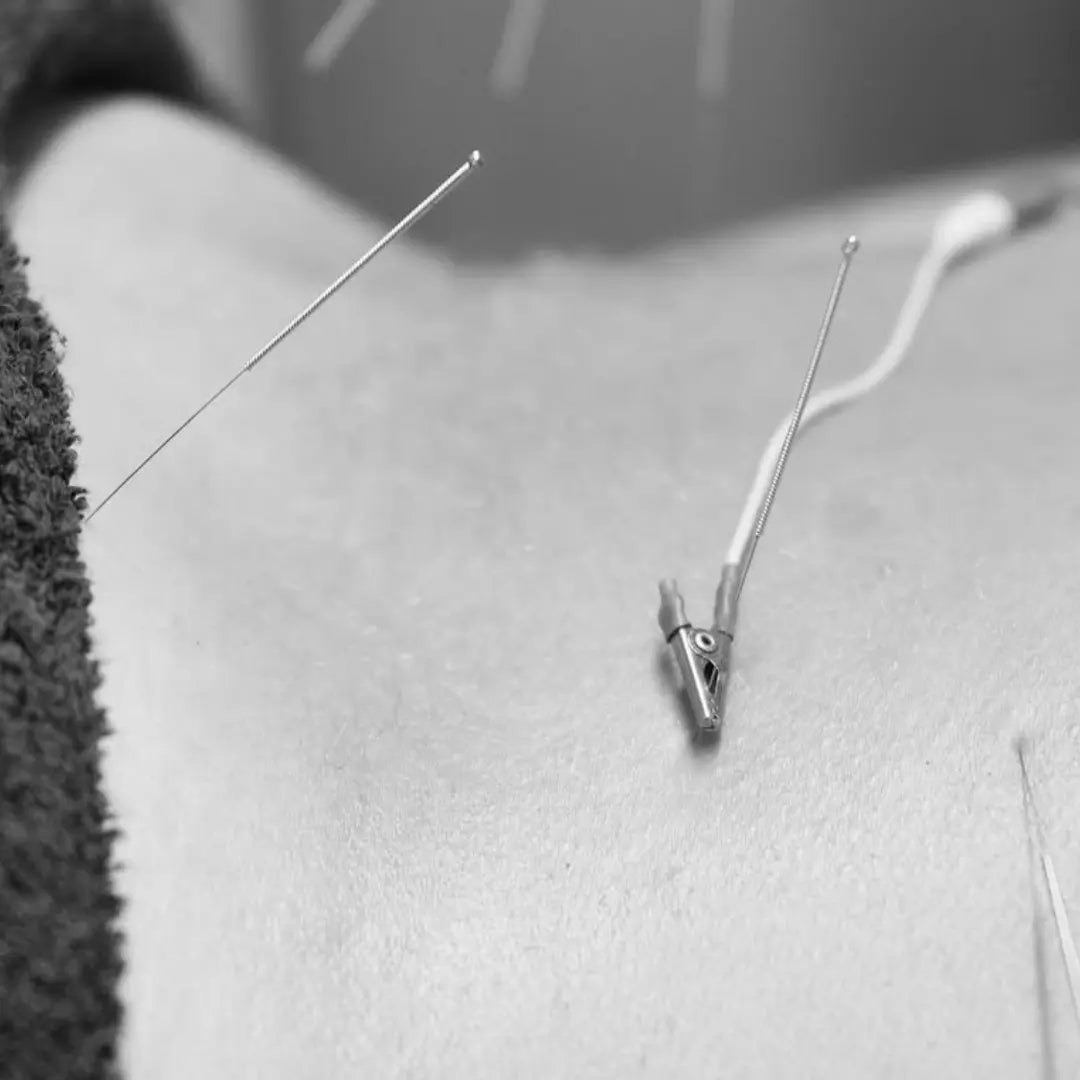 acupuncture the body expert