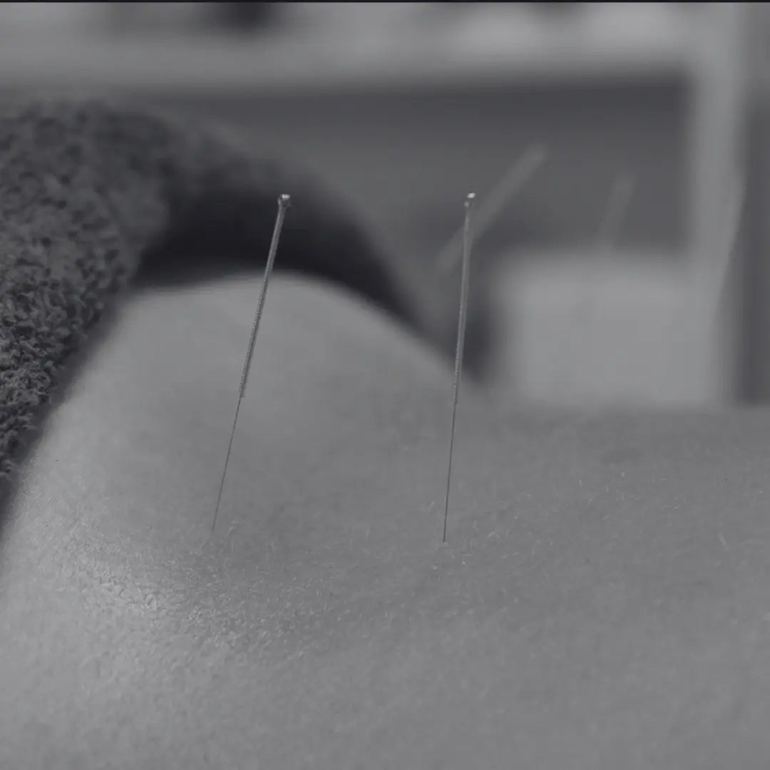 acupuncture the body expert