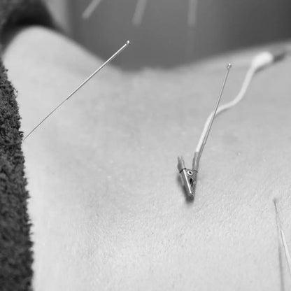 acupuncture the body expert