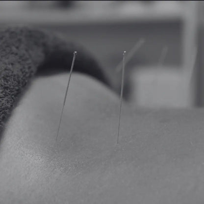 acupuncture the body expert