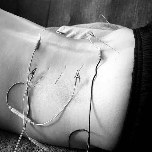 acupuncture the body expert