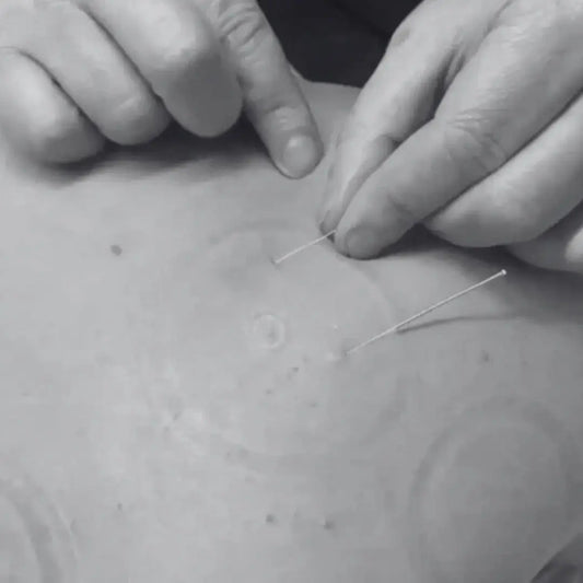 back recovery the body expert
