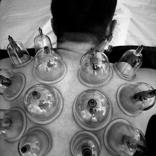 cupping the body expert